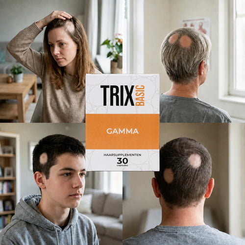 TRIX Basic Gamma per chiazze calve localizzate tipiche dell'alopecia areata in uomini e donne.
